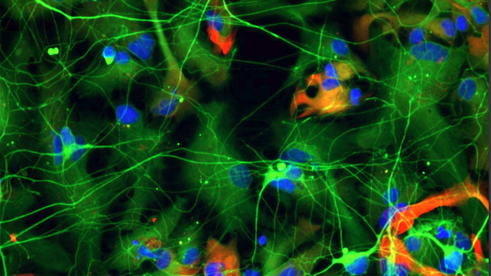 Human Neurons Rakesh Without Caption